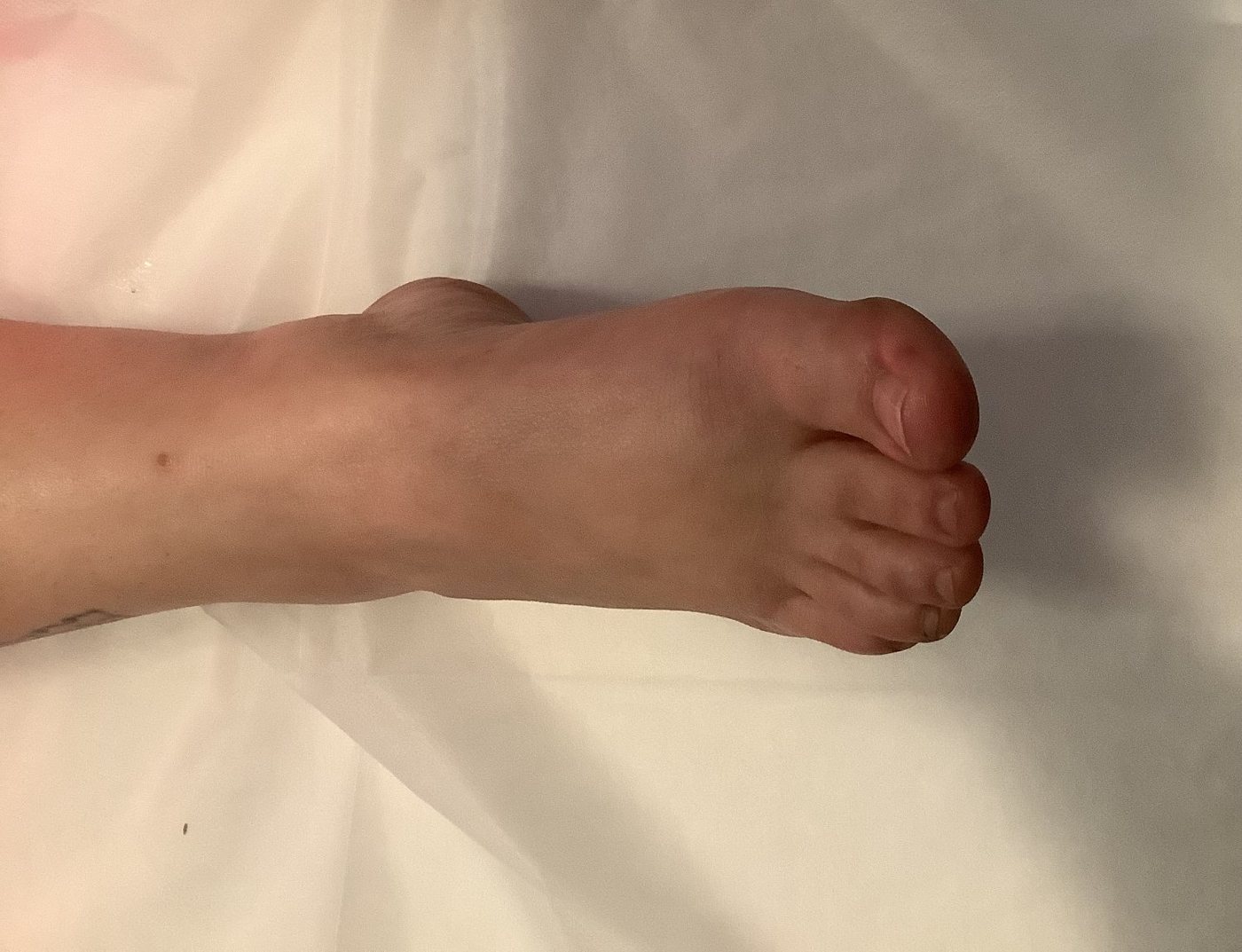 After lymphatic massage — visibly reduced swelling in foot